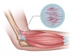 Fibres tendineuses des tendons au niveau de l'épicondyle